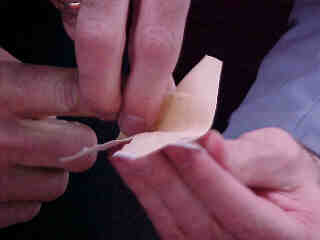 Anlegen eines Fingerverbandes (Gr&ouml;&szlig;e ca. 5,5 Kb)